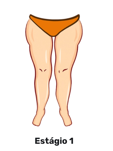 Novo Projeto (5)